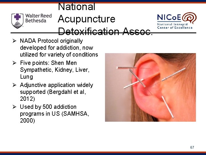 National Acupuncture Detoxification Assoc. Ø NADA Protocol originally developed for addiction, now utilized for