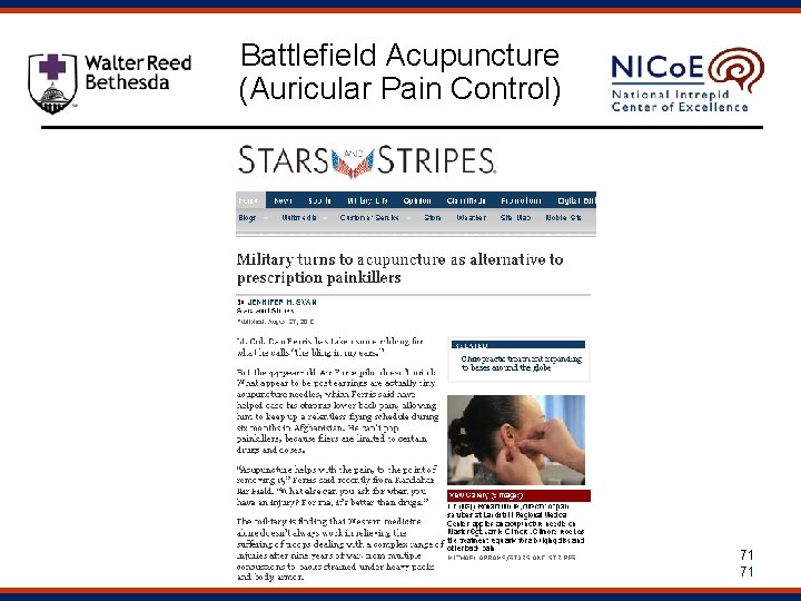 Battlefield Acupuncture (Auricular Pain Control) 71 71 