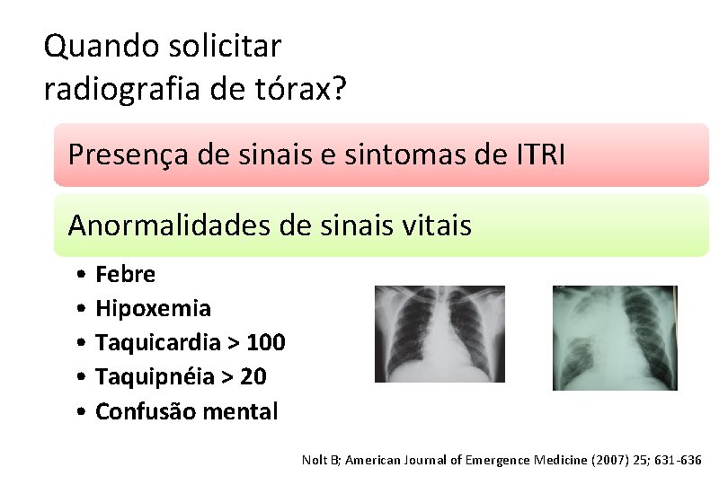 Quando solicitar radiografia de tórax? Presença de sinais e sintomas de ITRI Anormalidades de