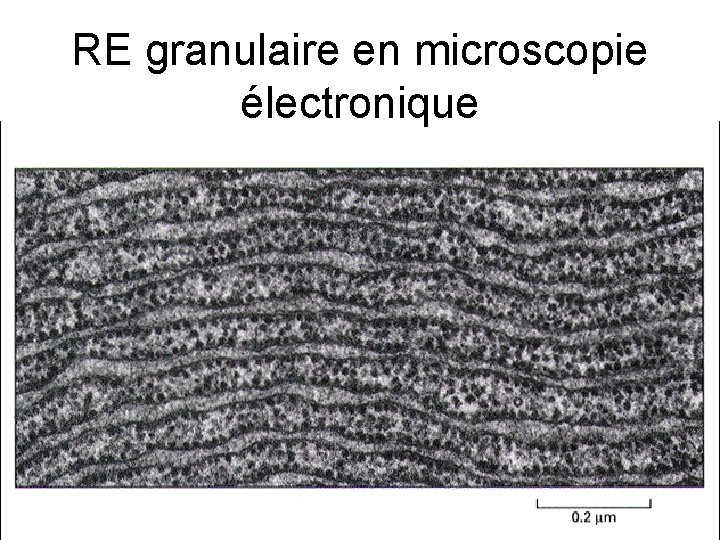 RE granulaire en microscopie électronique 
