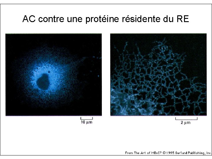 AC contre une protéine résidente du RE 