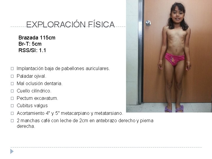EXPLORACIÓN FÍSICA Brazada 115 cm Br-T: 5 cm RSS/SI: 1. 1 � Implantación baja