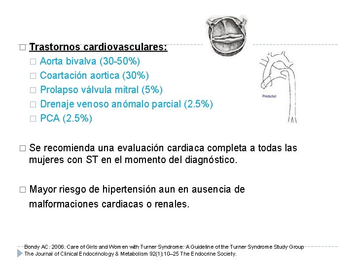 � Trastornos cardiovasculares: � Aorta bivalva (30 -50%) � Coartación aortica (30%) � Prolapso