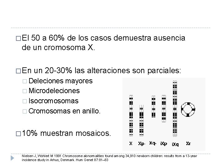 � El 50 a 60% de los casos demuestra ausencia de un cromosoma X.