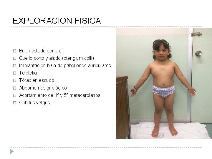 EXPLORACION FISICA � Buen estado general � Cuello corto y alado (pterigium colli) �