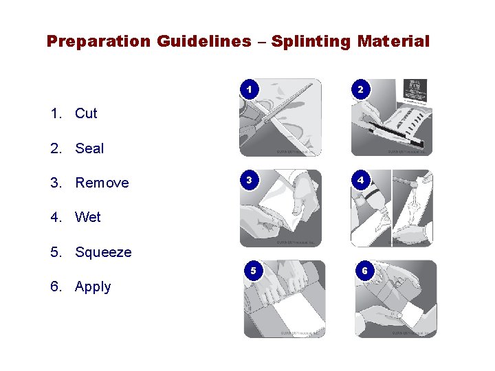 Preparation Guidelines – Splinting Material 1 2 3 4 1. Cut 2. Seal 3.