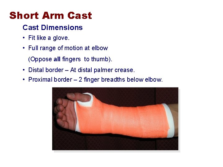 Short Arm Cast Dimensions • Fit like a glove. • Full range of motion