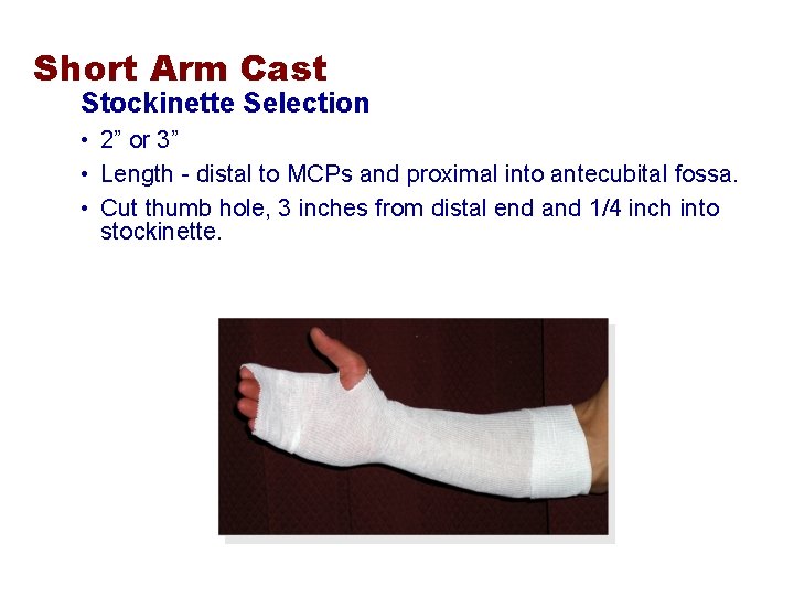 Short Arm Cast Stockinette Selection • 2” or 3” • Length - distal to