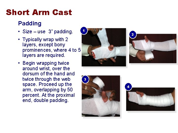 Short Arm Cast Padding • Size – use 3” padding. 1 2 • Typically