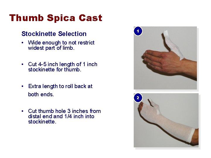 Thumb Spica Cast Stockinette Selection 1 • Wide enough to not restrict widest part