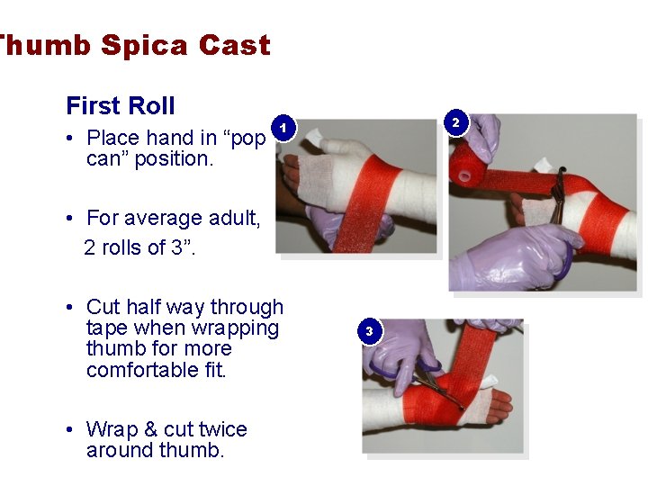 Thumb Spica Cast First Roll • Place hand in “pop can” position. 2 1