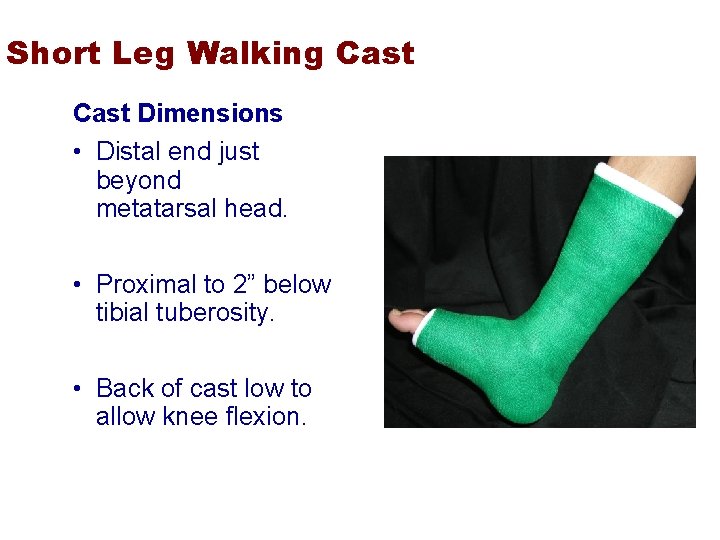 Short Leg Walking Cast Dimensions • Distal end just beyond metatarsal head. • Proximal