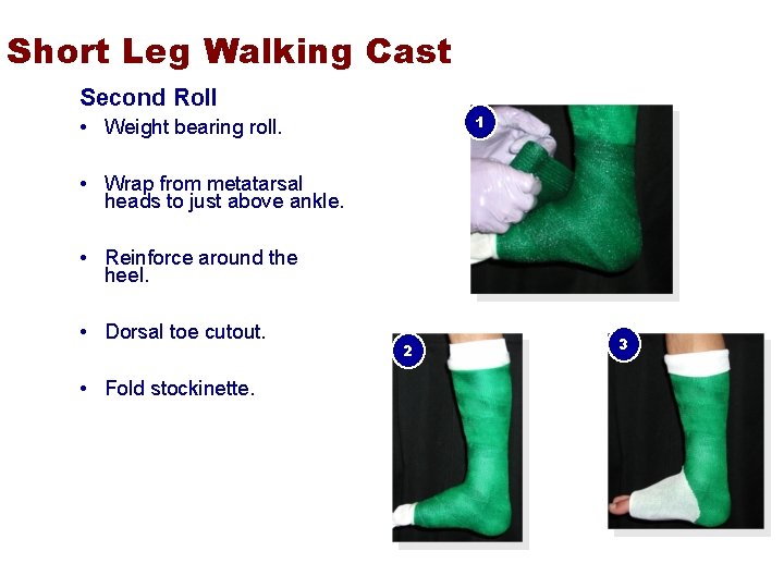 Short Leg Walking Cast Second Roll 1 • Weight bearing roll. • Wrap from