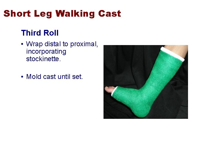 Short Leg Walking Cast Third Roll • Wrap distal to proximal, incorporating stockinette. •