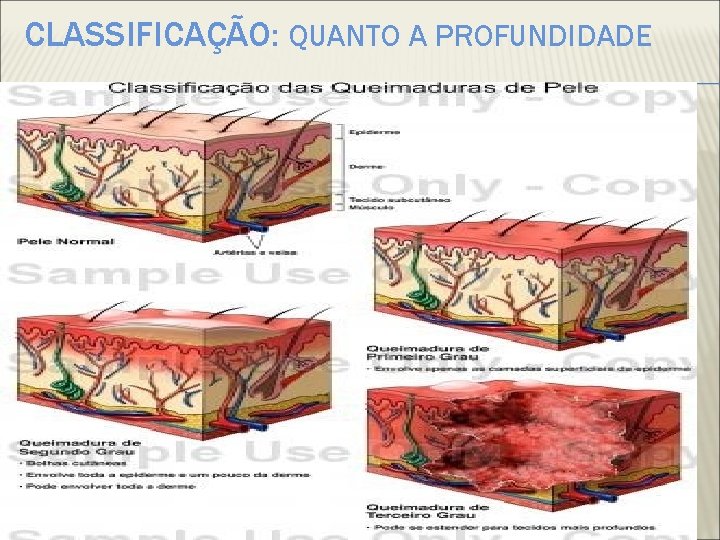 CLASSIFICAÇÃO: QUANTO A PROFUNDIDADE 