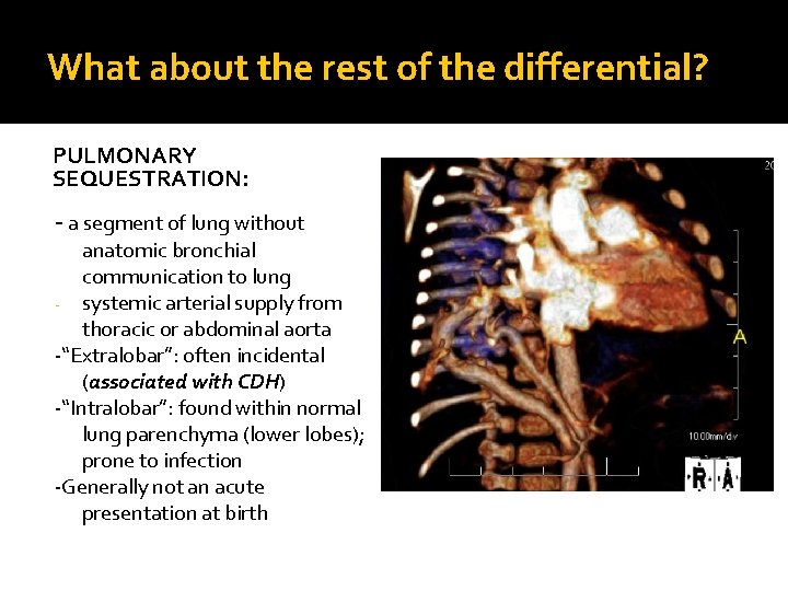 What about the rest of the differential? PULMONARY SEQUESTRATION: - a segment of lung