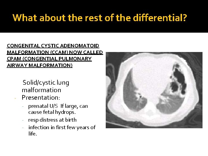 What about the rest of the differential? CONGENITAL CYSTIC ADENOMATOID MALFORMATION (CCAM) NOW CALLED