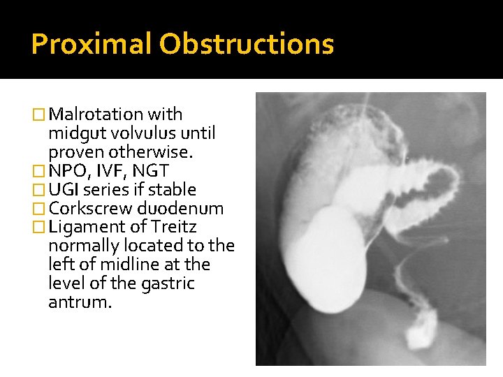 Proximal Obstructions � Malrotation with midgut volvulus until proven otherwise. � NPO, IVF, NGT