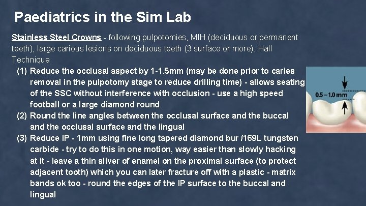 Paediatrics in the Sim Lab Stainless Steel Crowns - following pulpotomies, MIH (deciduous or