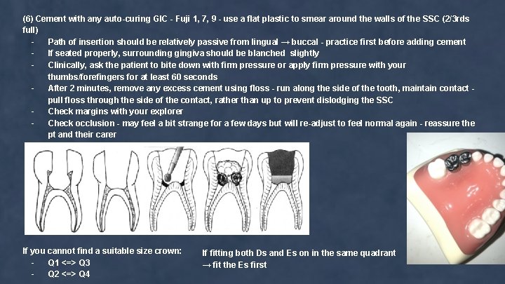 (6) Cement with any auto-curing GIC - Fuji 1, 7, 9 - use a
