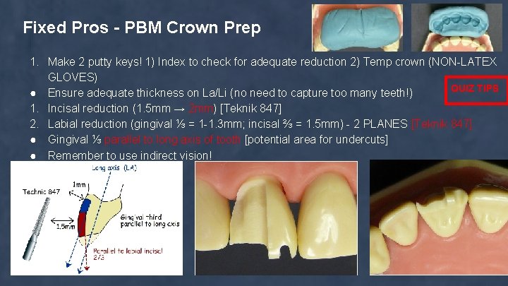 Fixed Pros - PBM Crown Prep 1. Make 2 putty keys! 1) Index to