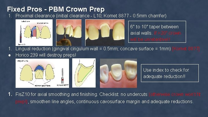 Fixed Pros - PBM Crown Prep 1. Proximal clearance (initial clearance - L 10;