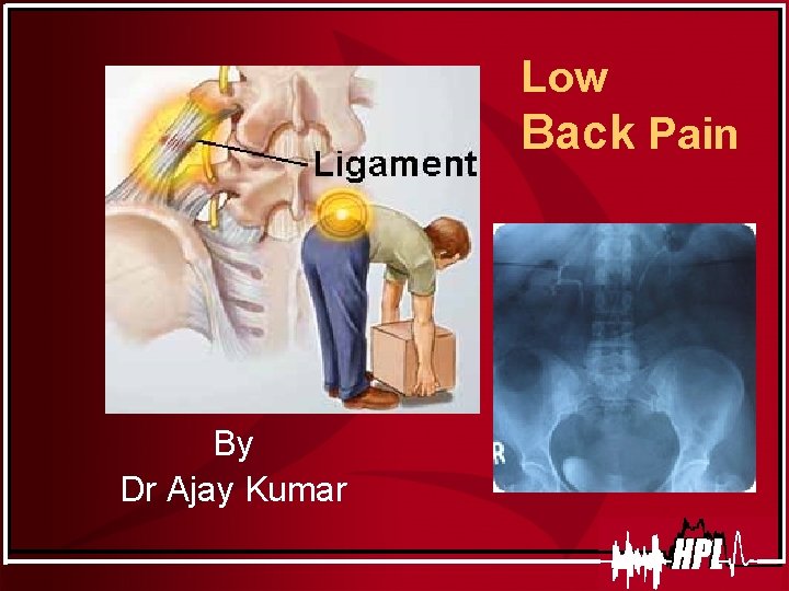 Low Back Pain By Dr Ajay Kumar 