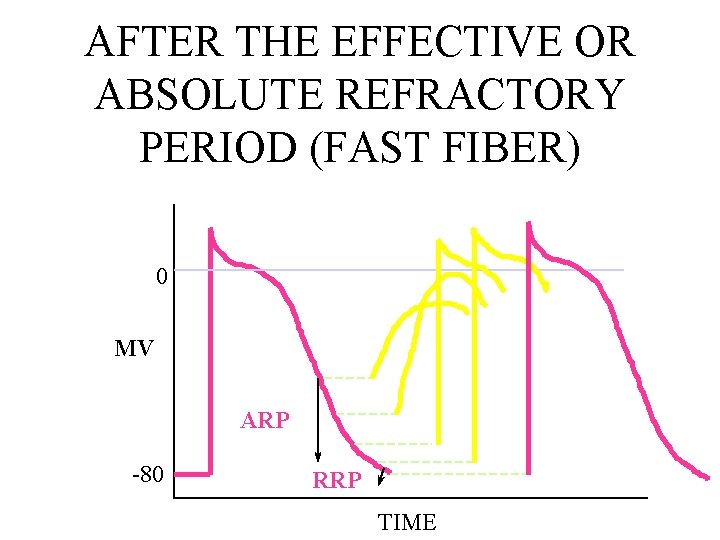 AFTER THE EFFECTIVE OR ABSOLUTE REFRACTORY PERIOD (FAST FIBER) 0 MV ARP -80 RRP