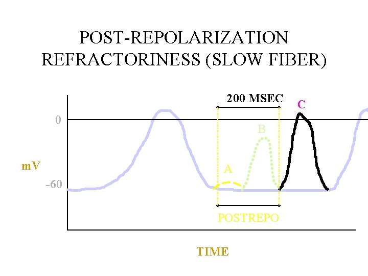 POST-REPOLARIZATION REFRACTORINESS (SLOW FIBER) 200 MSEC 0 m. V B A -60 POSTREPO TIME