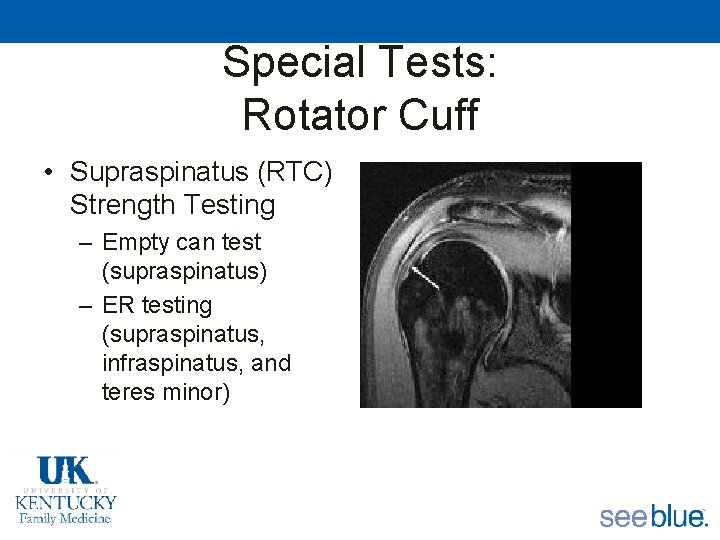 Special Tests: Rotator Cuff • Supraspinatus (RTC) Strength Testing – Empty can test (supraspinatus)