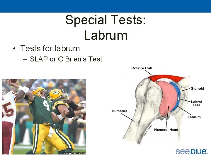 Special Tests: Labrum • Tests for labrum – SLAP or O’Brien’s Test 