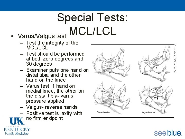  • Special Tests: MCL/LCL Varus/Valgus test – Test the integrity of the MCL/LCL