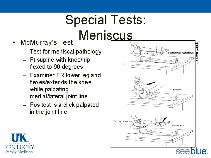  • Special Tests: Meniscus Mc. Murray’s Test – Test for meniscal pathology –