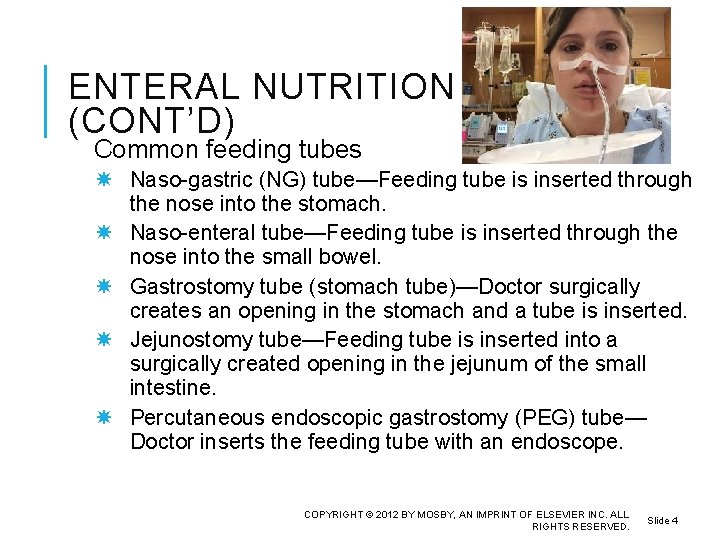 ENTERAL NUTRITION (CONT’D) Common feeding tubes Naso-gastric (NG) tube—Feeding tube is inserted through the
