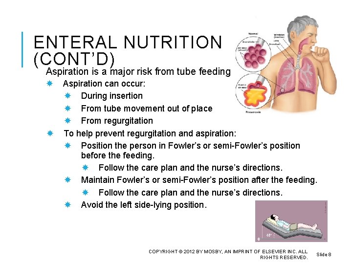 ENTERAL NUTRITION (CONT’D) Aspiration is a major risk from tube feedings. Aspiration can occur: