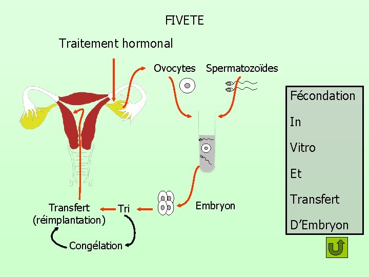 FIVETE Traitement hormonal Ovocytes Spermatozoïdes Fécondation In Vitro Et Transfert (réimplantation) Tri Congélation Embryon FIVETE Traitement hormonal Ovocytes Spermatozoïdes Fécondation In Vitro Et Transfert (réimplantation) Tri Congélation Embryon