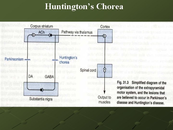 Huntington’s Chorea 