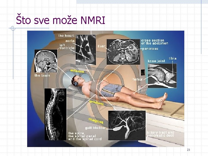 Što sve može NMRI 23 