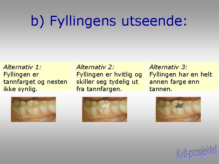 b) Fyllingens utseende: Alternativ 1: Fyllingen er tannfarget og nesten ikke synlig. Alternativ 2: