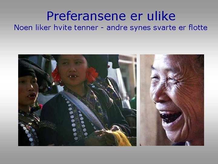 Preferansene er ulike Noen liker hvite tenner - andre synes svarte er flotte Preferansene er ulike Noen liker hvite tenner - andre synes svarte er flotte