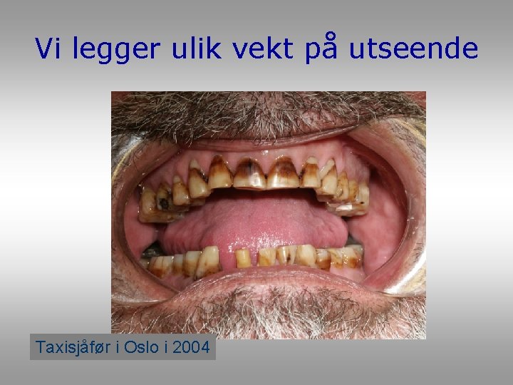 Vi legger ulik vekt på utseende Taxisjåfør i Oslo i 2004 Vi legger ulik vekt på utseende Taxisjåfør i Oslo i 2004