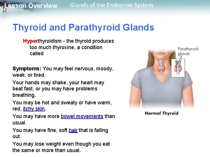 Lesson Overview Glands of the Endocrine System Thyroid and Parathyroid Glands Hyperthyroidism - the
