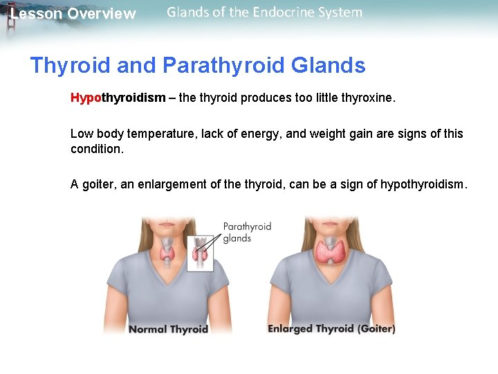 Lesson Overview Glands of the Endocrine System Thyroid and Parathyroid Glands Hypothyroidism – the Lesson Overview Glands of the Endocrine System Thyroid and Parathyroid Glands Hypothyroidism – the