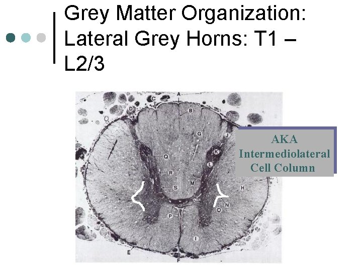 Grey Matter Organization: Lateral Grey Horns: T 1 – L 2/3 AKA Intermediolateral Cell