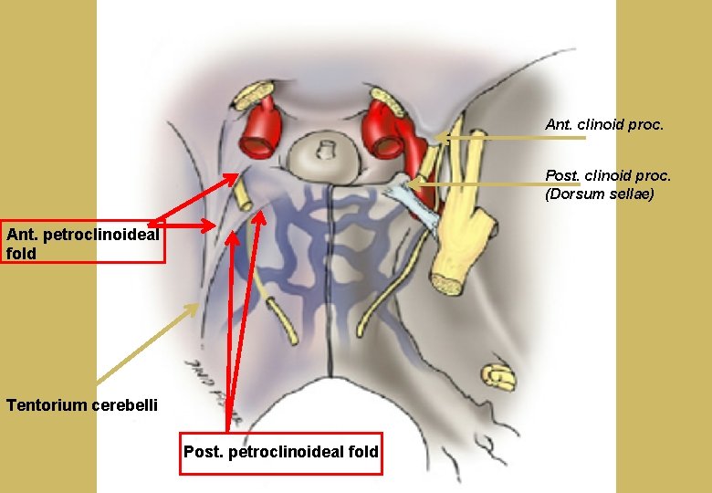 Ant. clinoid proc. Post. clinoid proc. (Dorsum sellae) Ant. petroclinoideal fold Tentorium cerebelli Post.