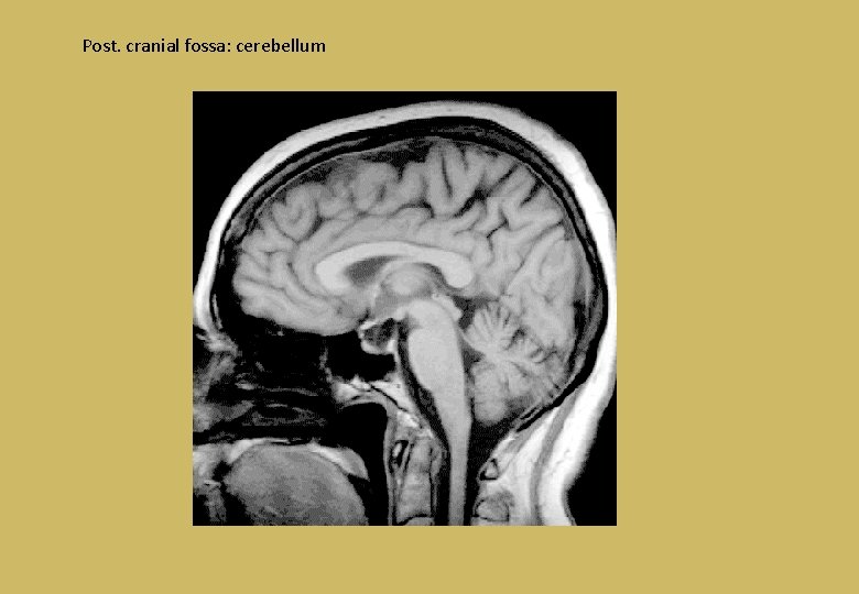 Post. cranial fossa: cerebellum 