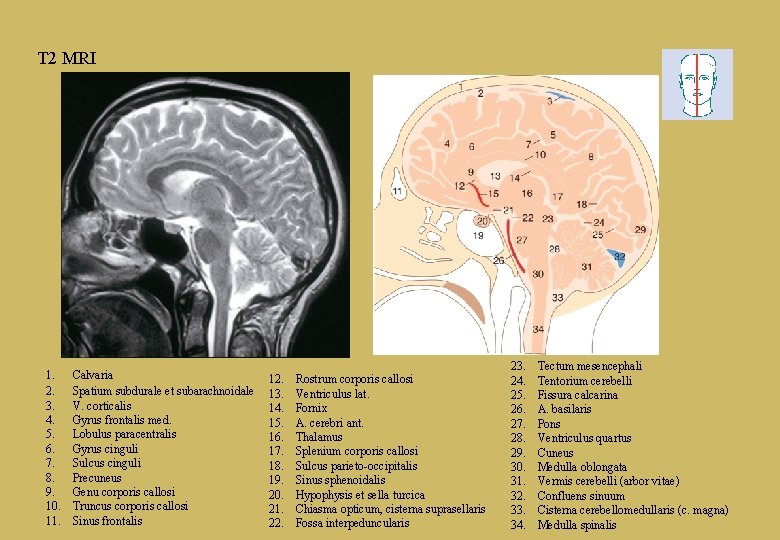 T 2 MRI 1. 2. 3. 4. 5. 6. 7. 8. 9. 10. 11.