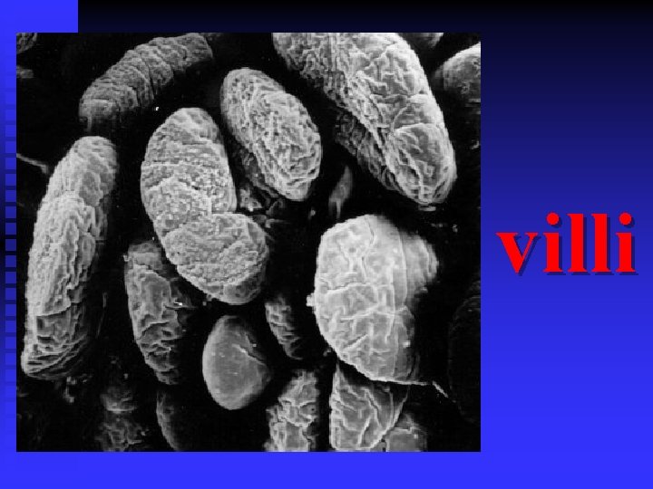 villi 