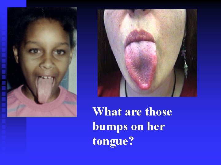 What are those bumps on her tongue? 