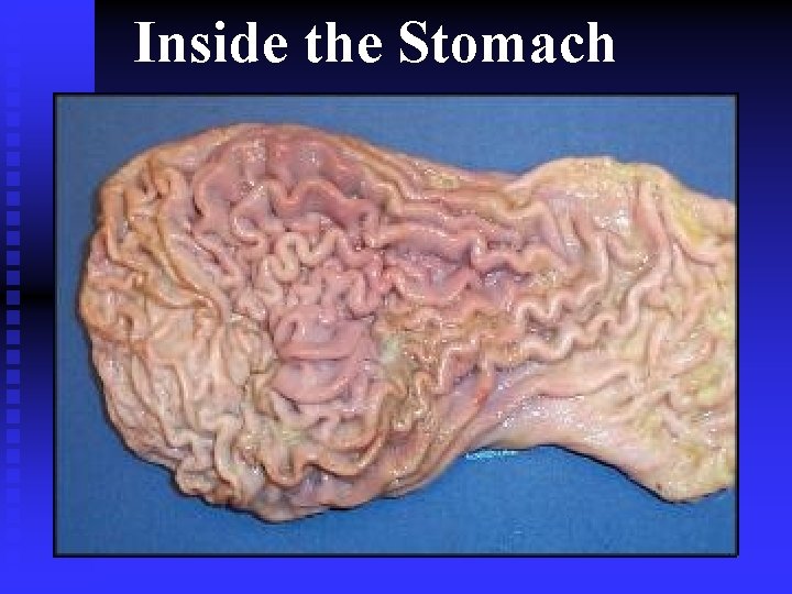 Inside the Stomach 